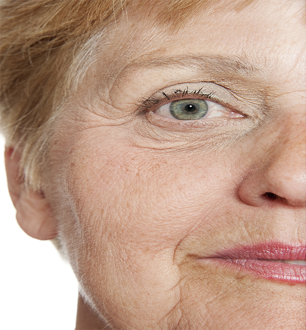 Before-facefour